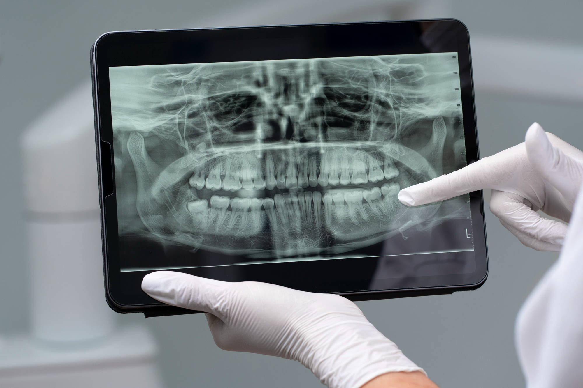 Digital dental imaging